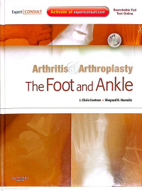 Image of Arthritis & Arthroplasty The Foot and Ankle